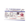Natural Ruby 11.81Ct — natural natural ruby manik gemstone view 5